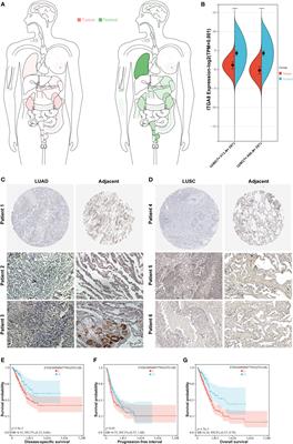 LINC01798/miR-17-5p axis regulates ITGA8 and causes changes in tumor microenvironment and stemness in lung adenocarcinoma